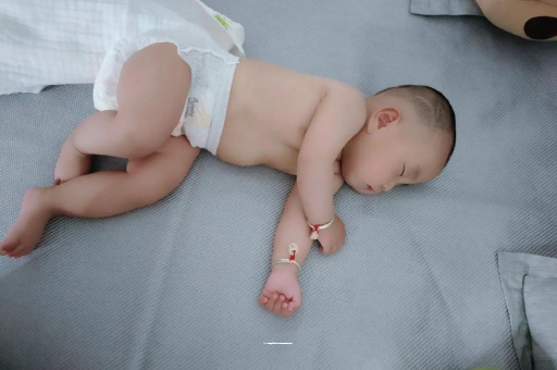 山西六个月宝宝眼睛散光